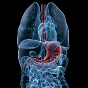 Malabsorption Syndrome related image